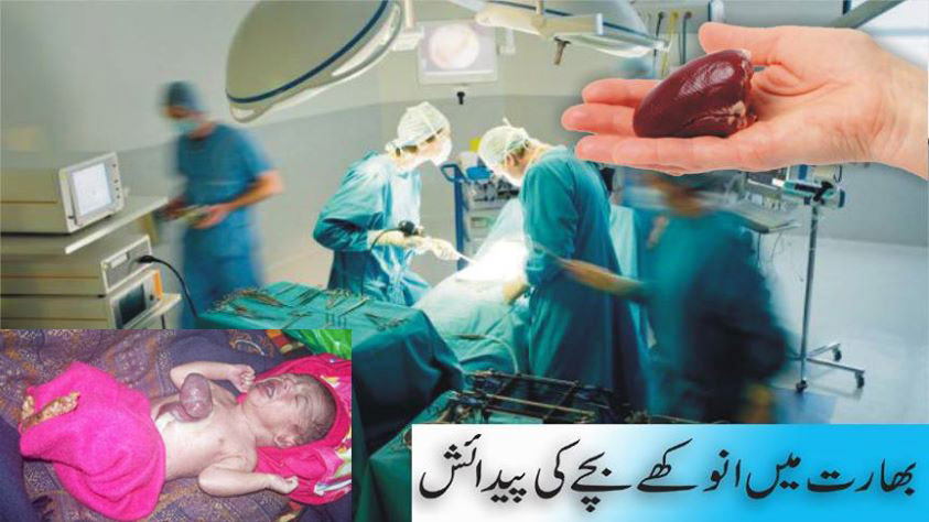 بھارت میں انوکھے بچے کی پیدائش